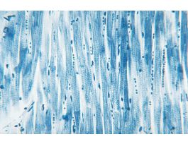 CARDIAC MUSCLE (MAMMALIAN) CS & LS