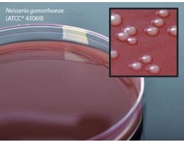 MEDIUM CHOCOLATE AGAR 15X100MM PLTD PK10