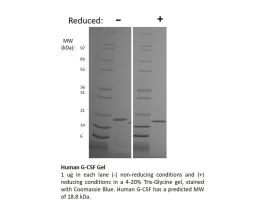 100-72AF-1MG HUMAN G-CSF (AF)