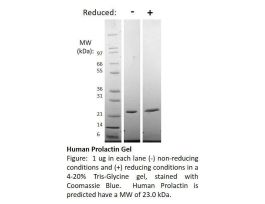 100-45-500UG HUMAN PROLACTIN