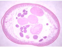 ASCARIS LUMBRICOIDES-MALES (CS) H&E