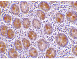 AATF ANTIBODY 100 UG