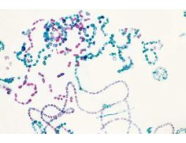 CYANOBACTERIA/TRUE BACTERIA (WM) & (SM)