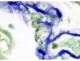 PNEUMOCYSTIS KIT 100RXN