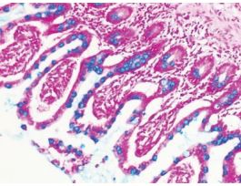 ALCIAN BLUE, PH 2.5 KIT 100RXN