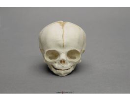 MODEL SKULL FETAL 30 WKS