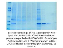KIT PUR YST 6X HIS PROTEIN HOOK NI 5RXN