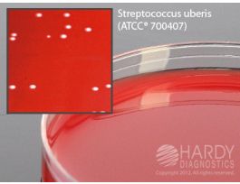 BOVINE BLOOD AGAR, 5%