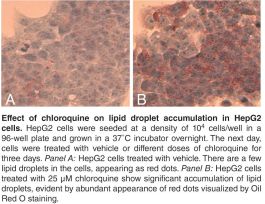 KIT STEATOSIS COLORIMETRIC ASSAY 4 DEG C