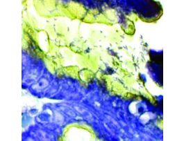 HELICO STAT KIT 100RXN