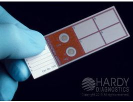 CONTROL SLIDE QC AFB STAIN SLIDE BX5