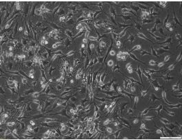 FLASK T150 XF MATRIX CELLS PLUS A SLEEVE