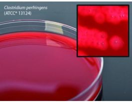 PLATE BRUCELLA AGAR W/H&K 15X100MM PK10
