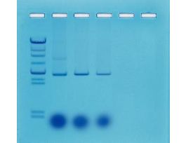 MINI-PREP ISOLATION OF PLASMID