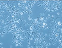 HBEpC-c: Human Bronchial Epithelial Cells (HBEpC)