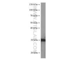 14-3-3 SIGMA MOUSE MONOCLONAL ANTIBODY