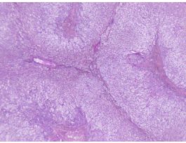 ADRENAL GLAND (SECT) H&E (HUMAN)