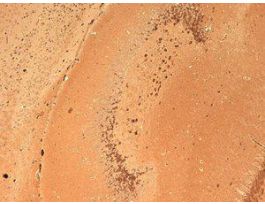 GLUR2 ANTIBODY 100UG