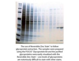 DESTAINING SOLN(10X) (COMP)