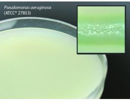 MEDIUM SKIM MILK AGR W/15X60MM PLTD PK10