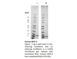 100-130-500UG HUMAN MCP-2 / CCL8
