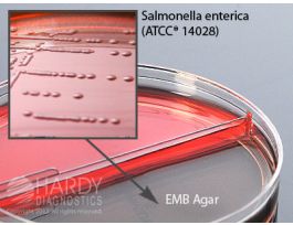BLOOD AGAR 5% EMB AGAR BIPLATE