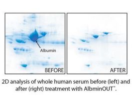 ALBUMINOUT 25PREPS F/ALBUMIN REMOVAL