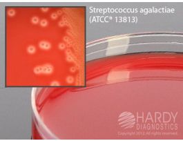 GBS DETECT GROUP B STREP 15X100MM 10/PK