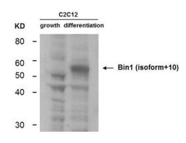 BIN1 ANTIBODY 25UL