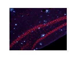 AMYLO-GLO RTD PLAQUE STAIN REAGENT 4DEGC