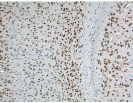 A2BP1 POLYCLONAL ANTIBODY
