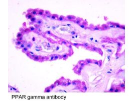 CK PAB TO PPAR GAMMA