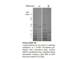 100-02AF-1MG HUMAN GDNF (AF)