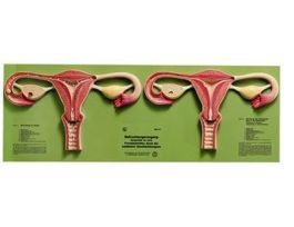 MODEL FERTILIZATION PROCESS