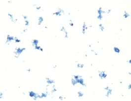 CRYPTOSPORIDIUM PARVUM (SMEAR) COCCIDIAN