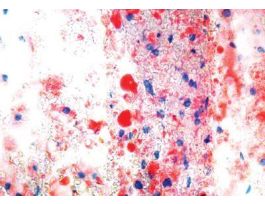 OIL RED O KIT 100RXN