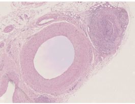 ARTERY VEIN & CAPILLARY (MAMMALIAN) CS
