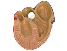 MODEL MINI HEART DISEASE SET