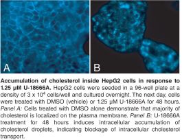 KIT DETCN ASY 192 WL CHOLESTEROL CEL-BSD