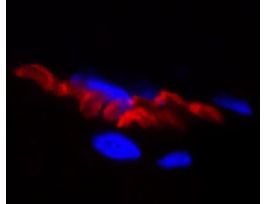 ALPHA-BUNGAROTOXIN CF594