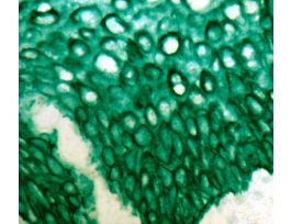 PERMAGREEN PLUS/AP CHROMOGEN 110ML