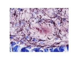 BLACK-GOLD II MYELIN DILUTE STAINING KIT