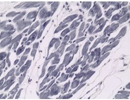HEART MUSCLE (HUMAN) CS & LS