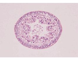HYDRA-GENERAL STRUCTURE (CS) H&E