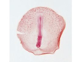 CHICK 33-HOUR (WM) SLIDE 11-14 SOMITES