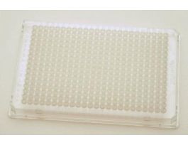 PLATE TWINTEC PCR 384 CLR PK25