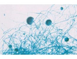 BREAD MOLD (RHISOPUS NIGRICANS) WM