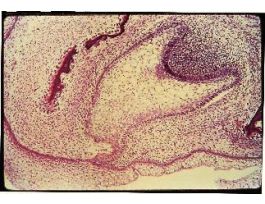 DENTAL CUP (SECT) MAL SLIDE (PIG FETUS)