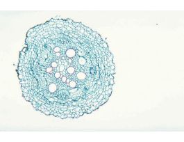 HELIANTHUS ROOT (CS) QS MATURE ROOT