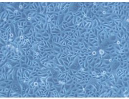 NHEK ADULT SINGLE DONOR PELLET